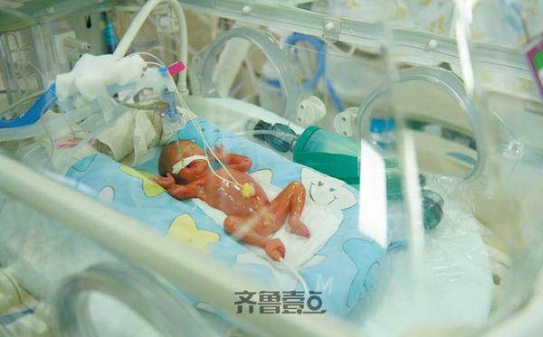 国内最小早产儿济南出生23周零4天530克图