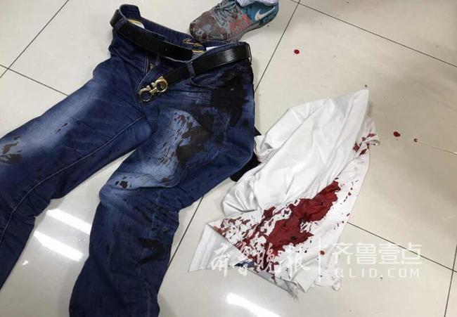 遇酒托还是起冲突?男子济南餐厅吃饭被砍4刀鲜血淋漓