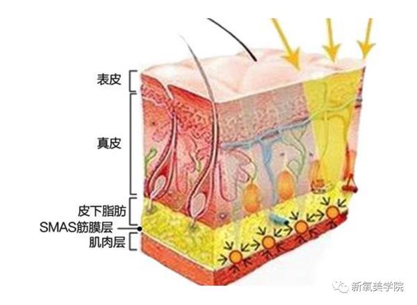 肌肉含量的下降,会导致肌肉以外的浅层组织失去支撑,引发松弛和皱纹
