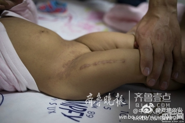 直播:护送患儿出国治疗 夏津公安赴京为其面签